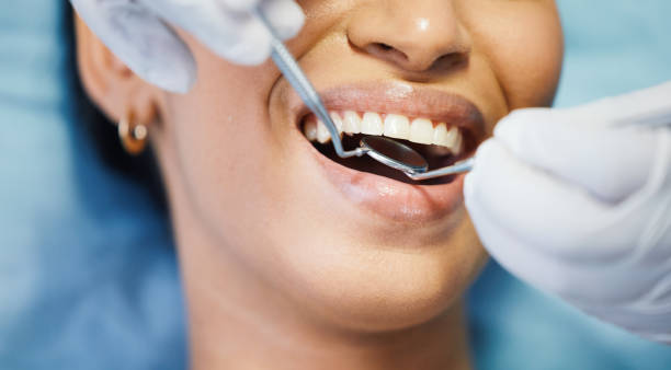 Best Emergency Dentist for Lost Fillings or Crowns in La Salle, CO